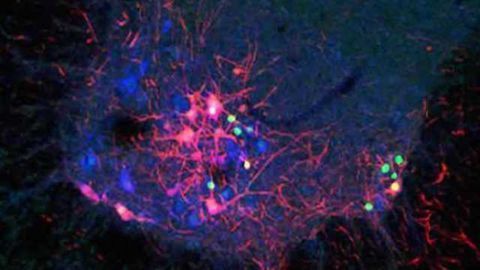 New viral tools to safely trace brain circuits developed