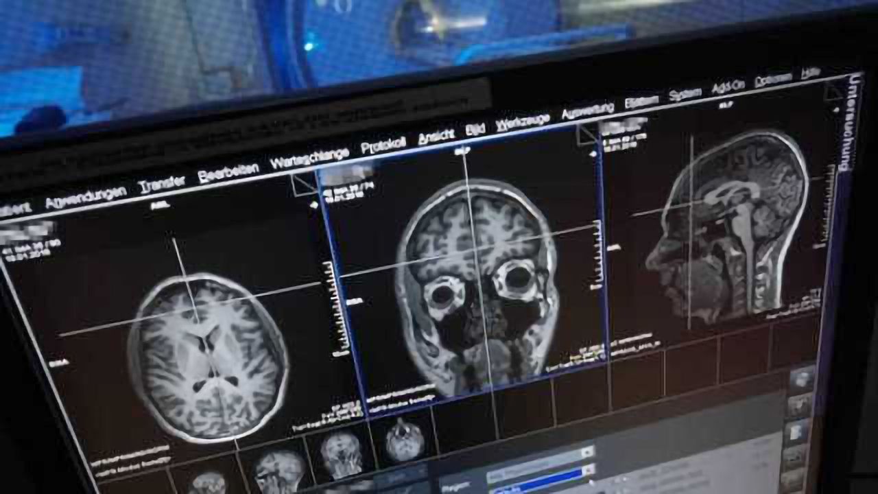 Both hemispheres of the brain process numbers