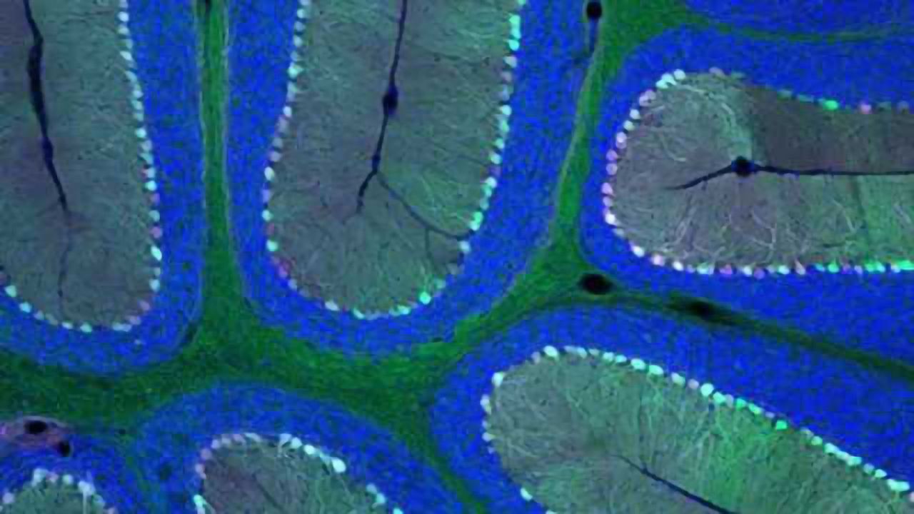 Delivering genes across the blood-brain barrier