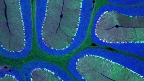 Delivering genes across the blood-brain barrier