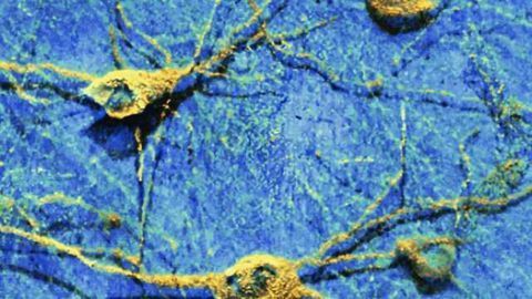 Graphene shown to safely interact with neurons in the brain