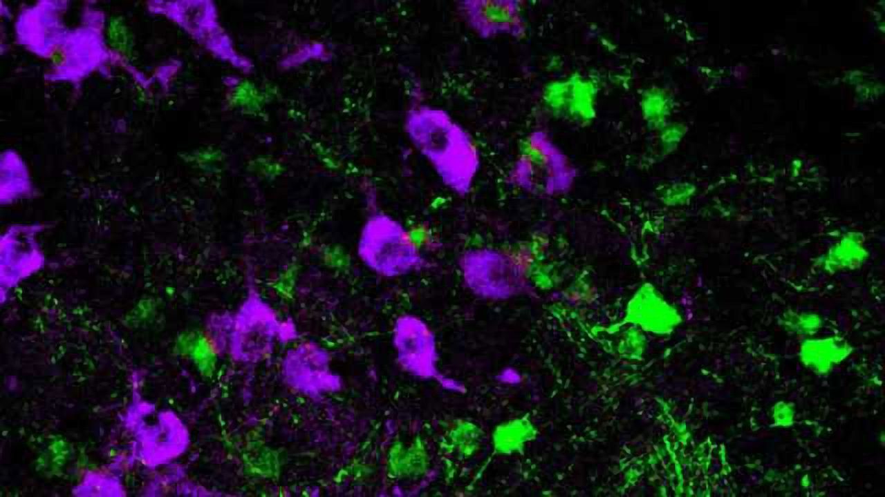 Treating Parkinson’s disease by solving the mysteries of movement
