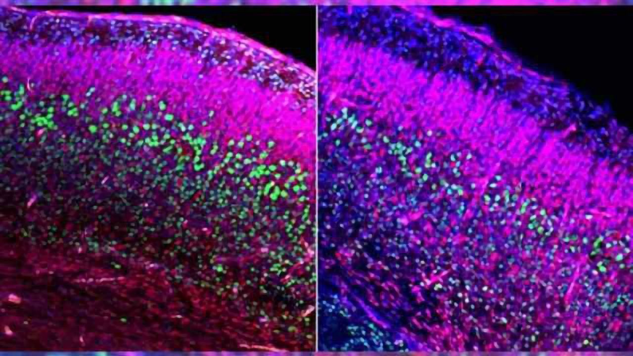 Newly identified pathway links fetal brain development to adult social and repetitive behavior