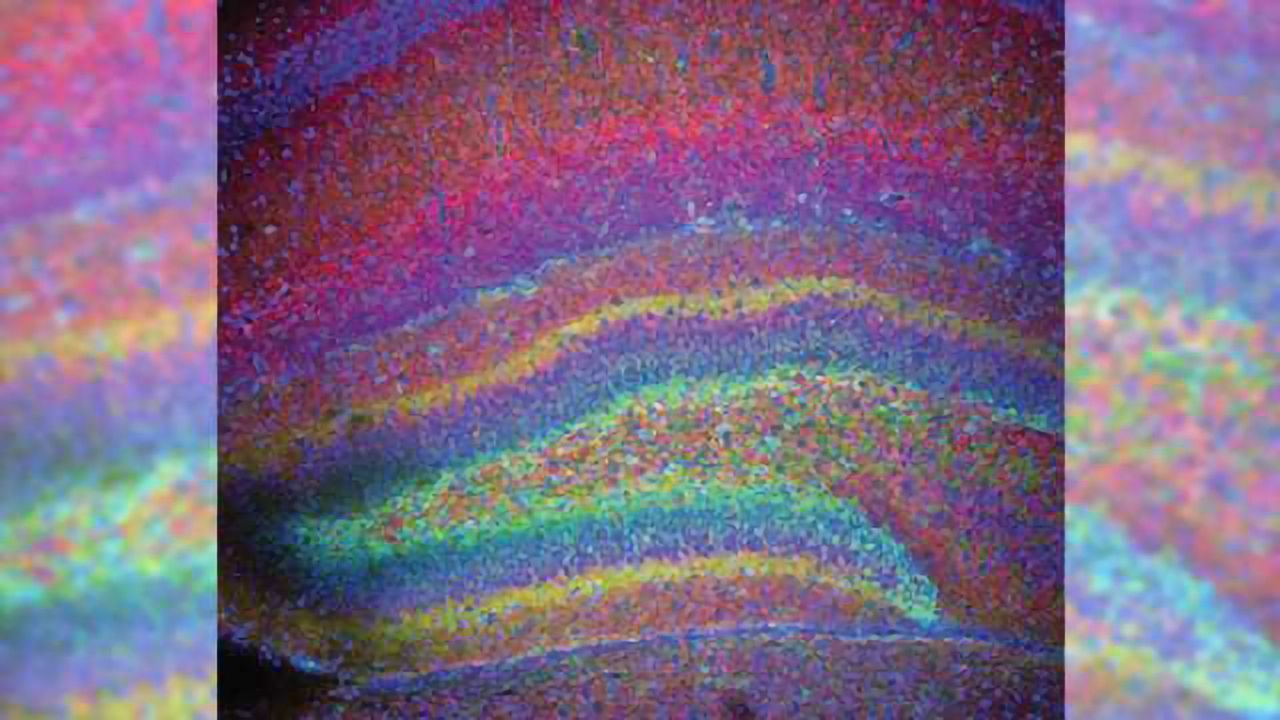 Researchers hone in on why female newborns are better protected from brain injury