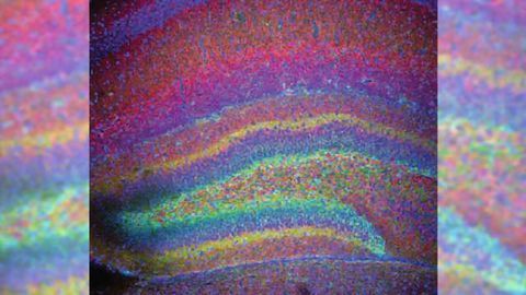 Researchers hone in on why female newborns are better protected from brain injury