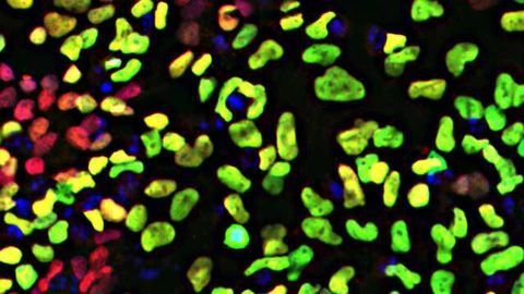 Study reports a fast, robust model for developing neural crest cells