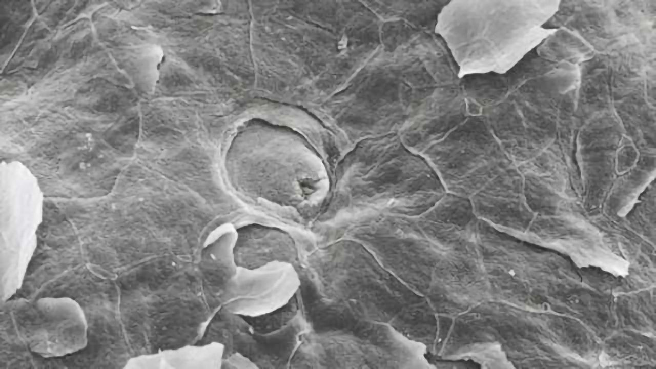 Brain scars in multiple sclerosis patients reveal possible cause of taste problems