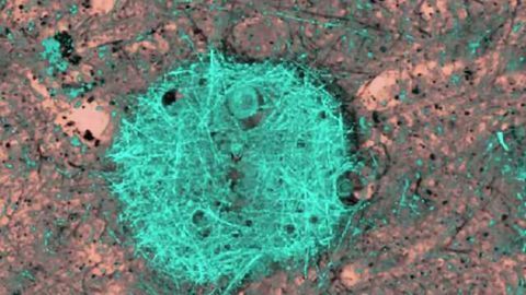 Researchers identify 'neurostatin' that may reduce the risk of Alzheimer's disease