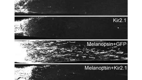 Enhancing neuronal activity promotes axon regeneration in adult CNS