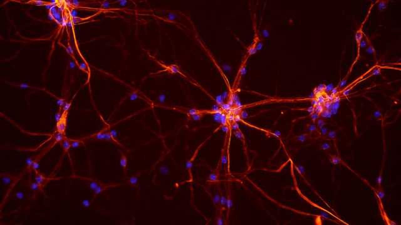 Teaching neurons to respond to placebos as potential treatment for Parkinson’s