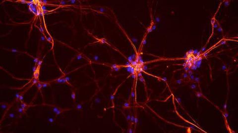 Teaching neurons to respond to placebos as potential treatment for Parkinson’s