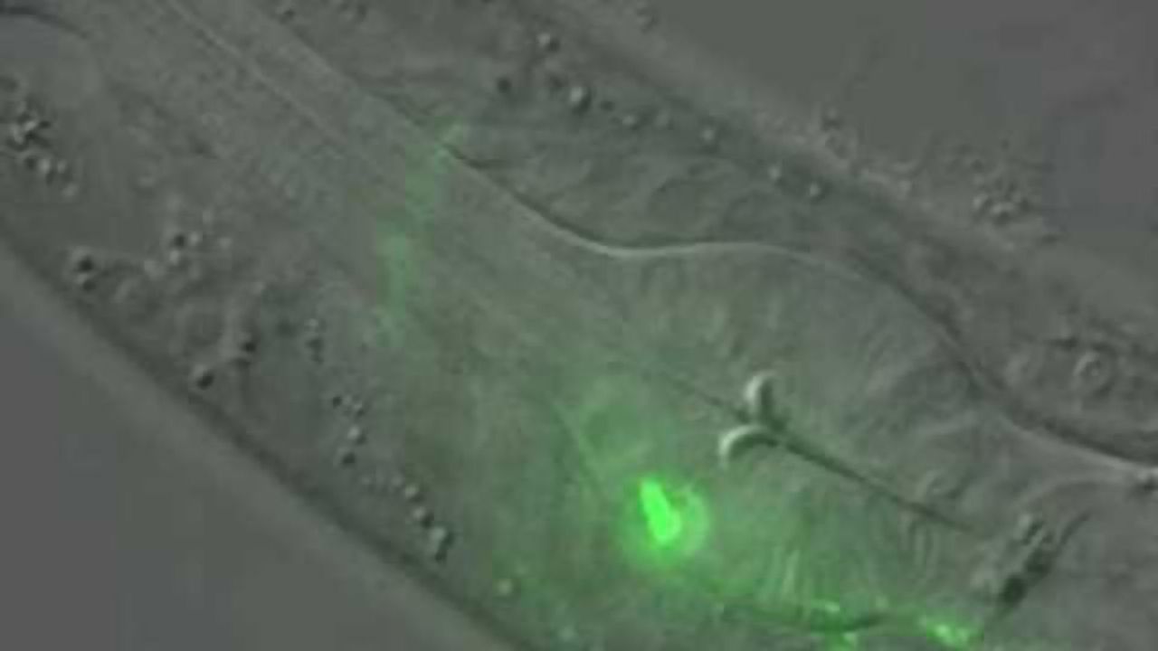 Studying worms' food choices shows how young brains form lifelong memories