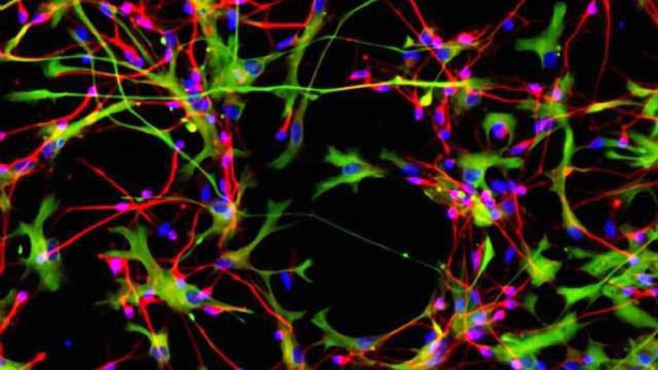 Researchers create 'mini-brains' in lab to study neurological diseases