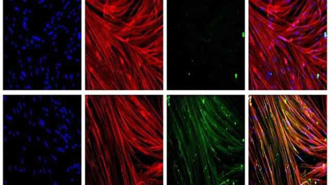 Stem cell gene therapy could be key to treating Duchenne muscular dystrophy