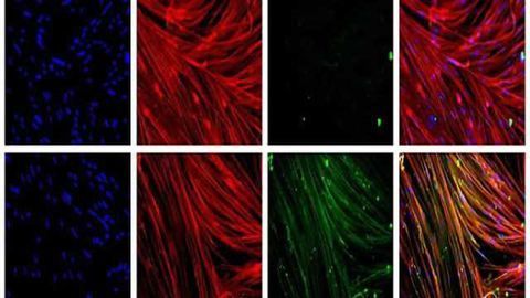 Stem cell gene therapy could be key to treating Duchenne muscular dystrophy