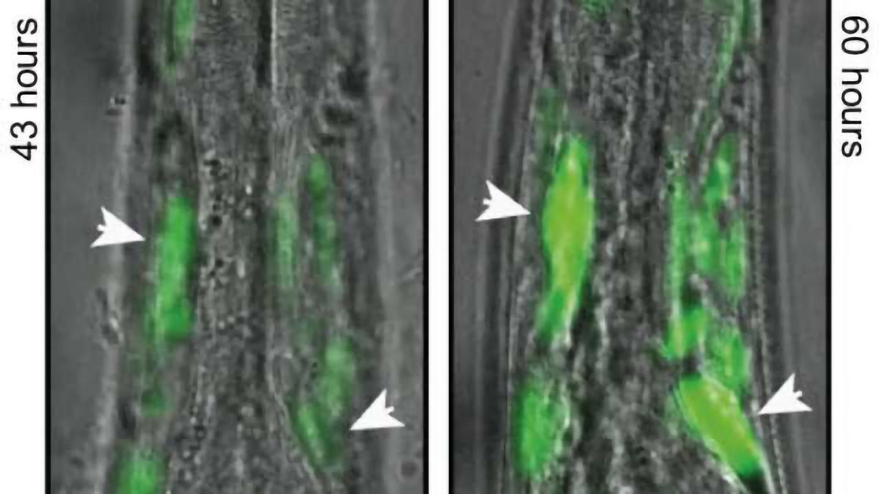 Observing brain diseases in real time