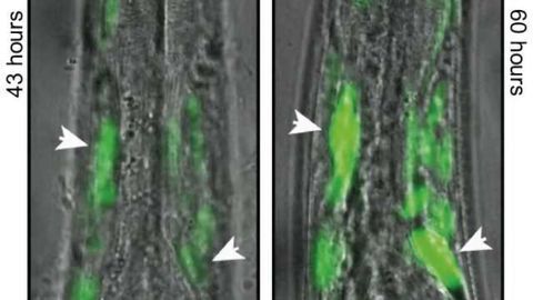 Observing brain diseases in real time