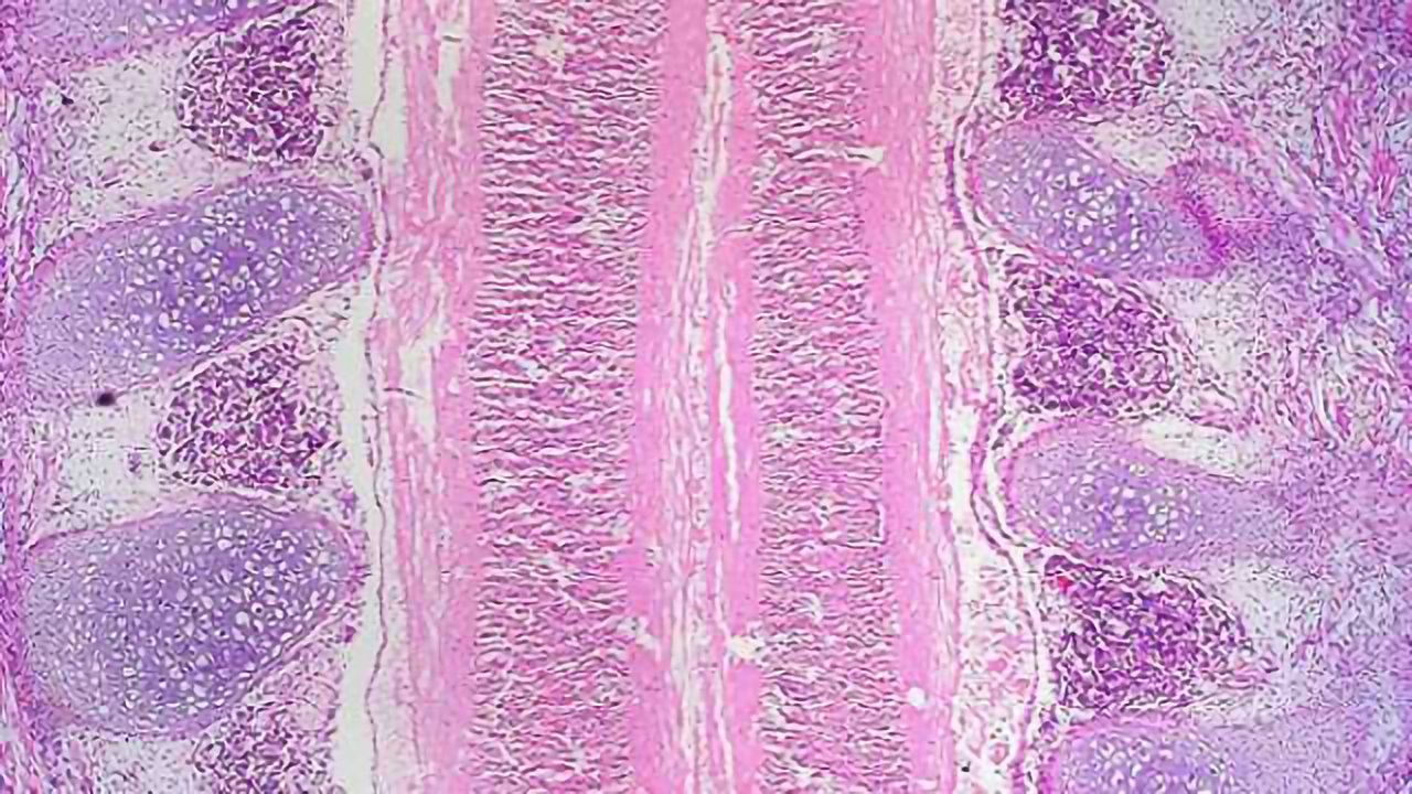 TAxI shuttles protein cargo into spinal cord