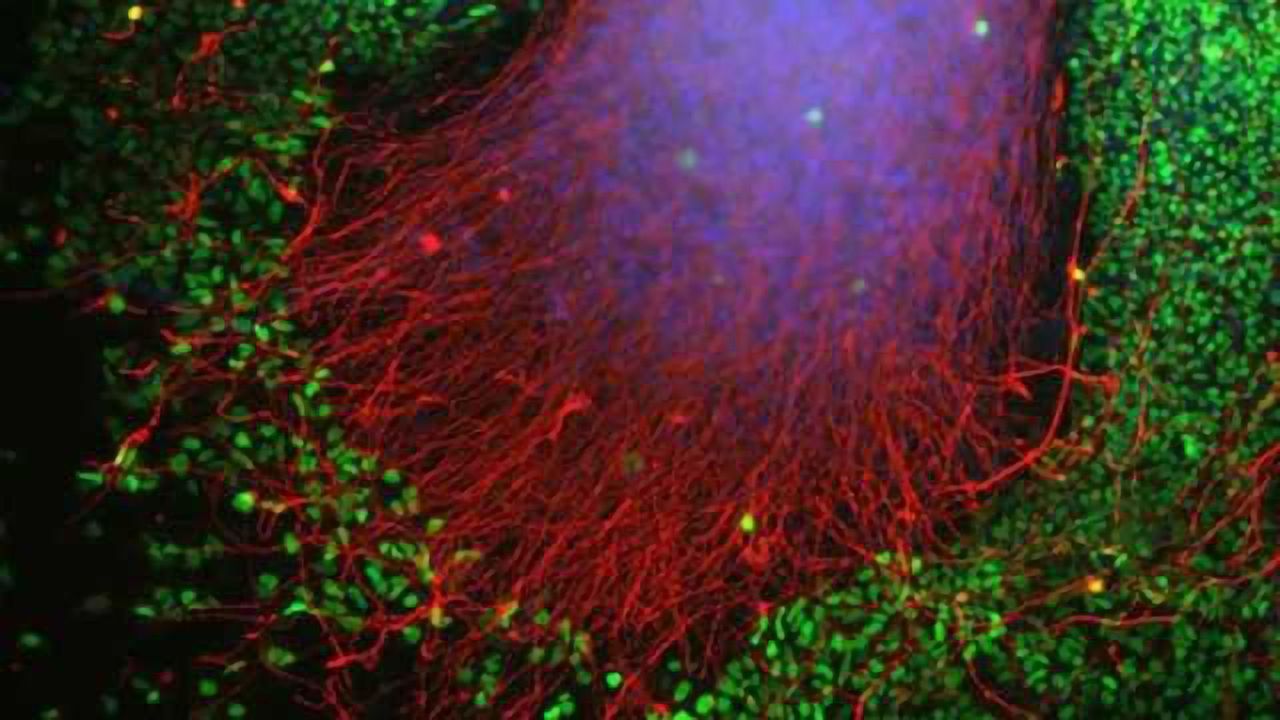 Stemming the flow: Stem cell study reveals how Parkinson's spreads