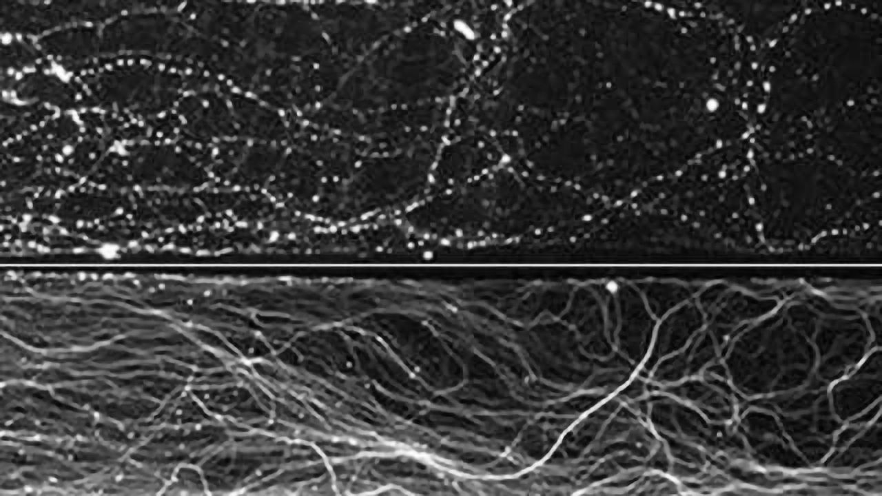Questions raised on popular theory about how the nervous system trims its branches