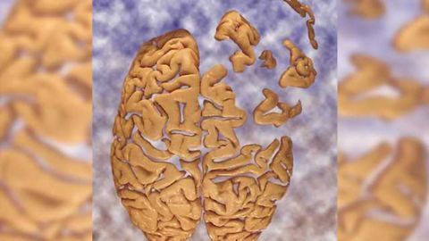 Environmental contaminants increase risk of dementia