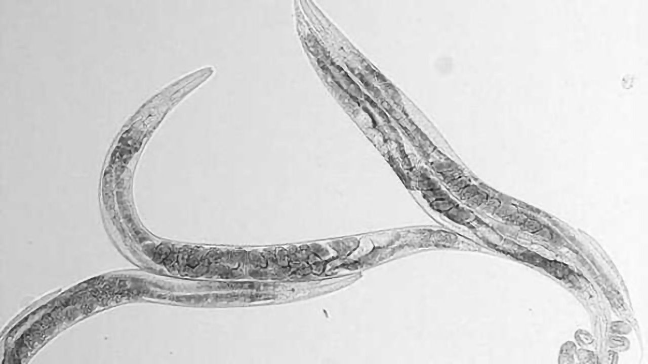 Tracking worm sex drive, neuron by neuron