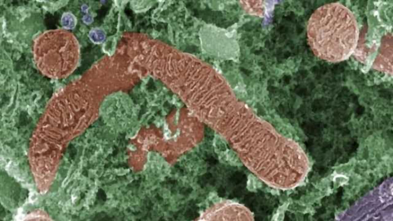 Sugar rush shrinks brain cell powerhouse