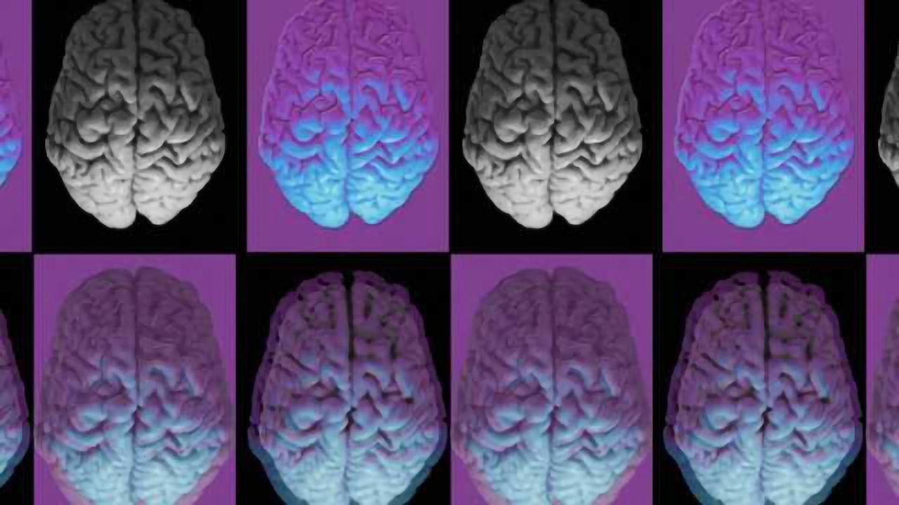 Discovery of key abnormality affecting brain development in people with Down syndrome