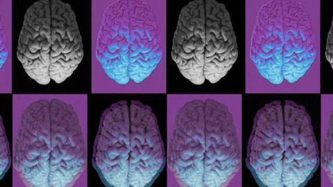 Discovery of key abnormality affecting brain development in people with Down syndrome