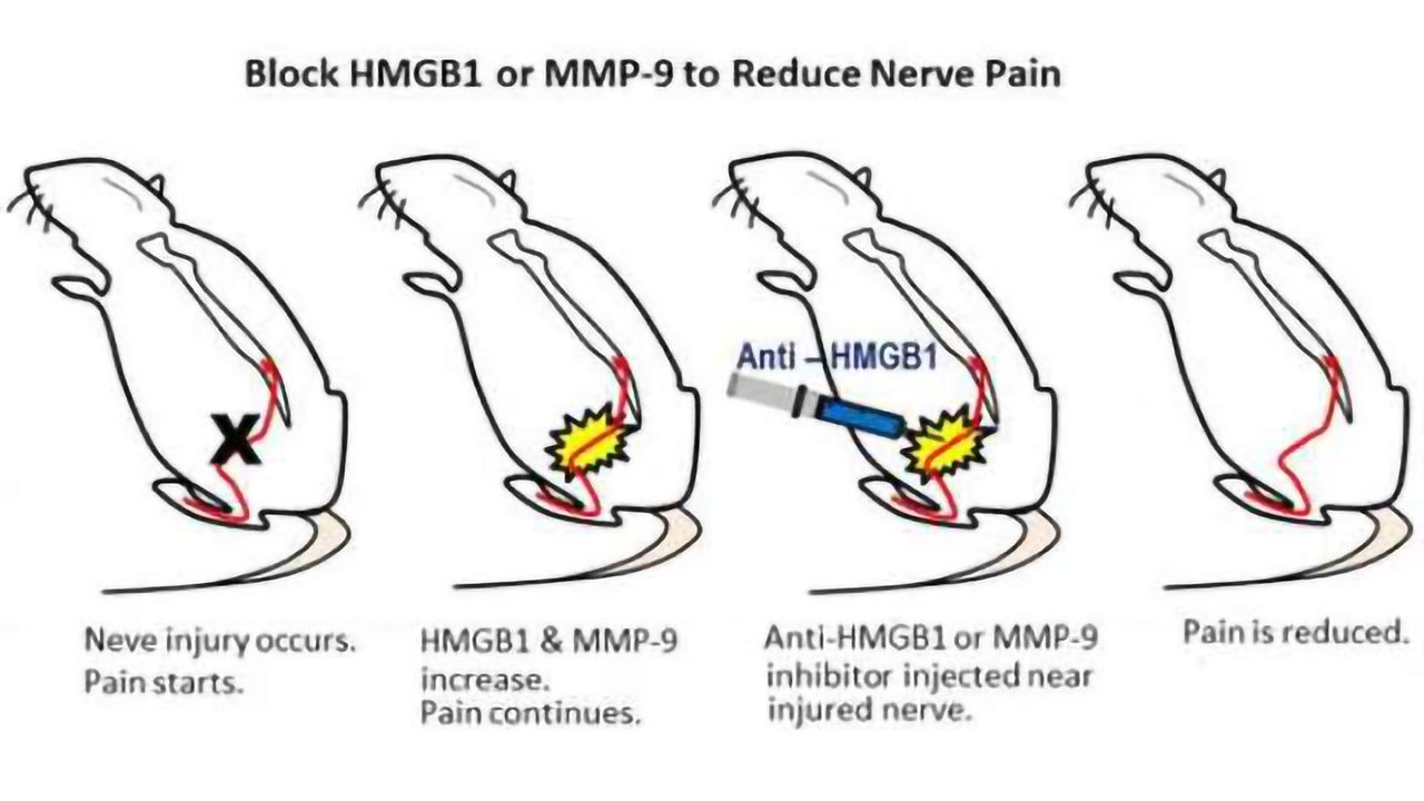 New targets for reducing nerve pain identified