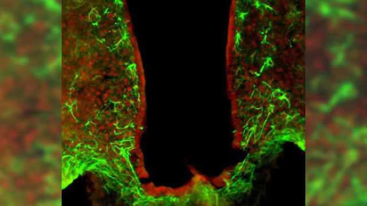 Researchers identify genetic switch regulating satiety and body weight