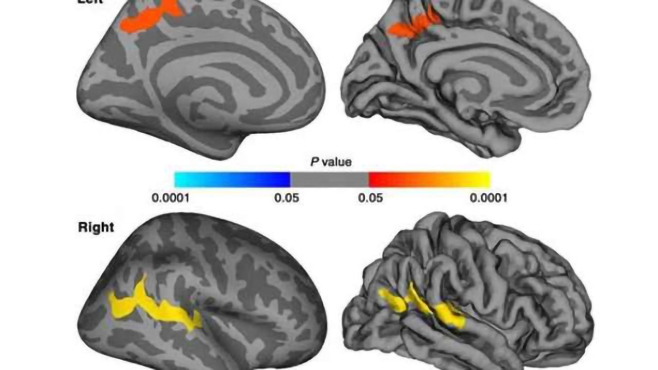Imaging shows impact of PTSD in earthquake survivors