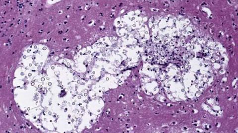 Neutrophils 'vacuum' microbes away from the brain