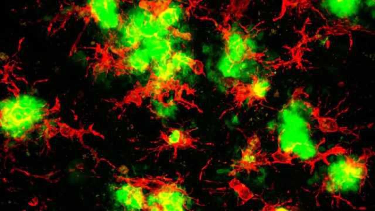 Blocking inflammation prevents cell death, improves memory in Alzheimer's disease