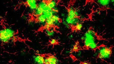 Blocking inflammation prevents cell death, improves memory in Alzheimer's disease