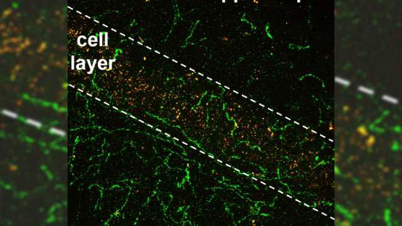 Both sides now: Dopamine, the "reward" molecule, controls learning to avoid unpleasant experiences, study finds