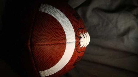 New formula can predict professional football players' long-term concussion damages
