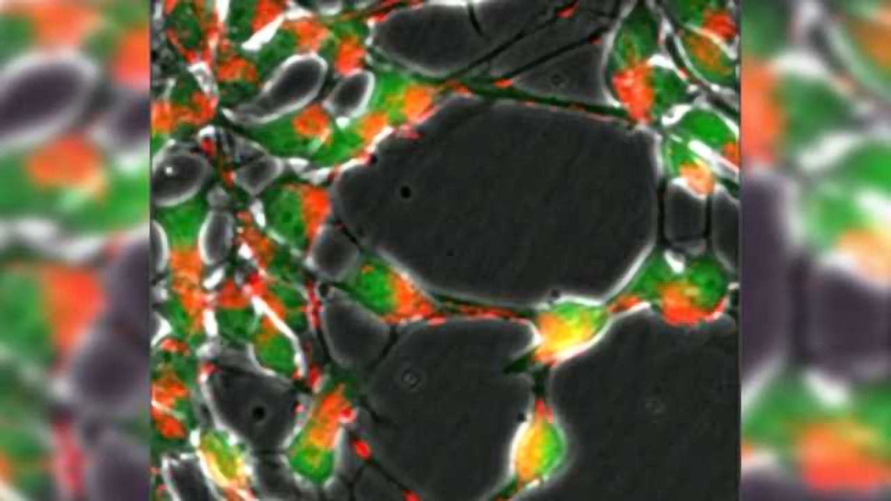 New approaches for Parkinson's treatment?