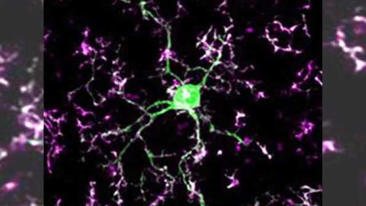 The brain’s gardeners: Immune cells ‘prune’ connections between neurons