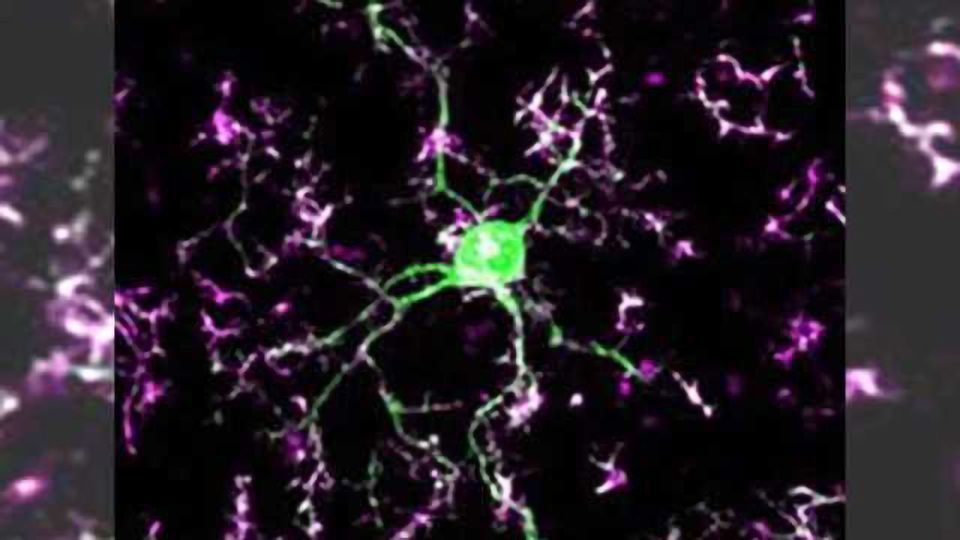 The brain’s gardeners: Immune cells ‘prune’ connections between neurons content piece image