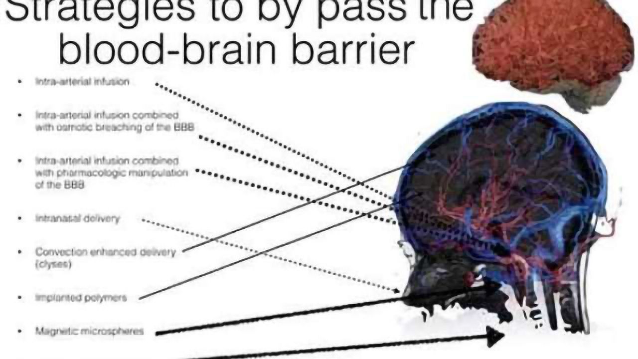 Delivery strategies of chemotherapy to the central nervous system