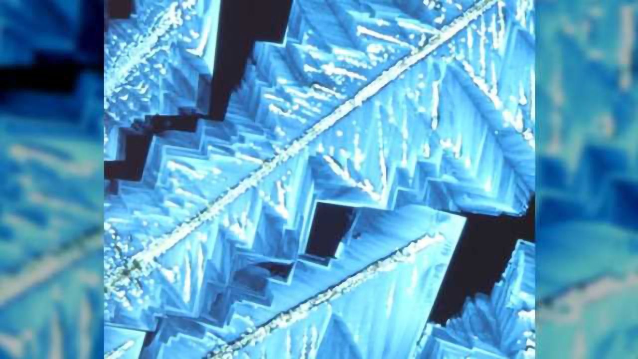 Serotonin deficiency implicated in rheumatoid arthritis