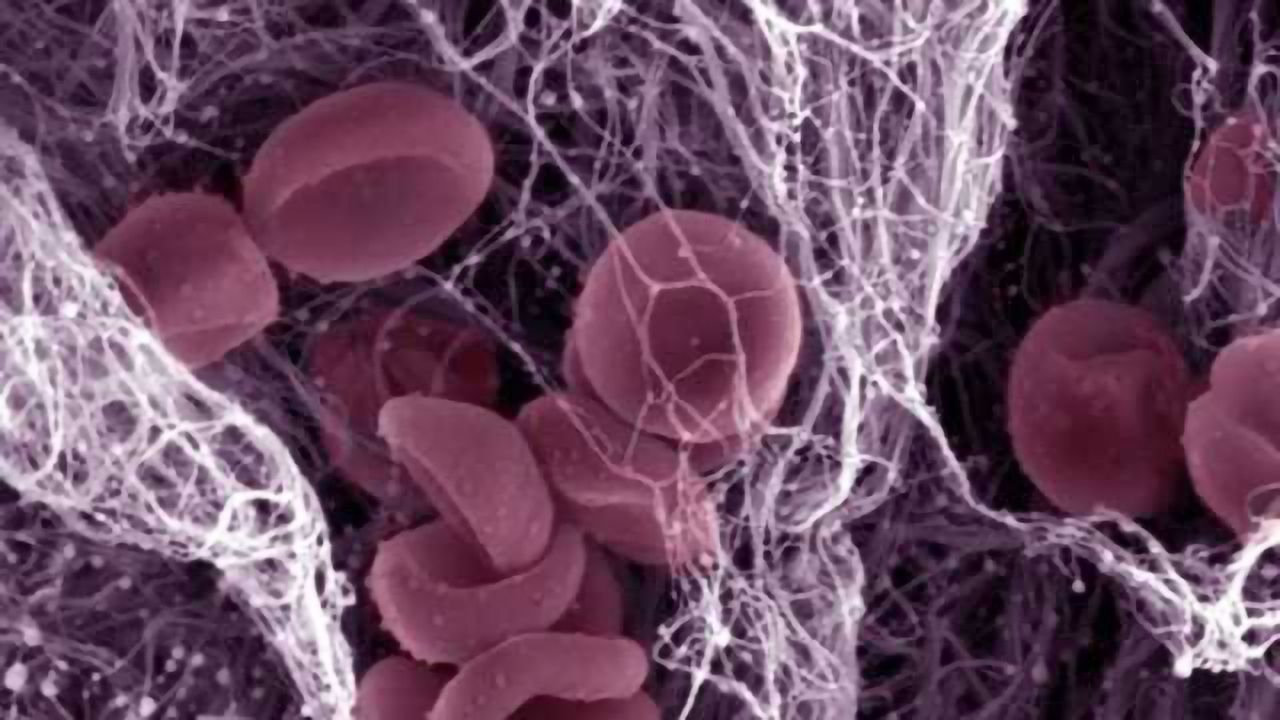 New imaging technique may give physicians a clearer picture of stroke damage