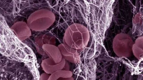 New imaging technique may give physicians a clearer picture of stroke damage
