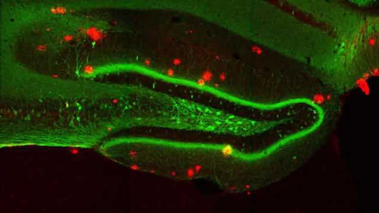 Flipping a light switch recovers memories lost to Alzheimer's disease mice