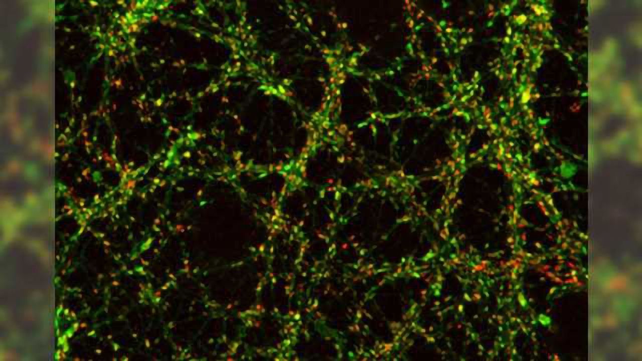 Temporary disconnects shed light on long-term brain dysfunction