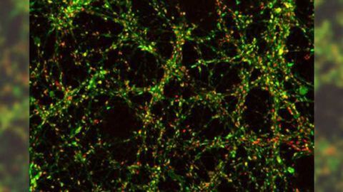 Temporary disconnects shed light on long-term brain dysfunction