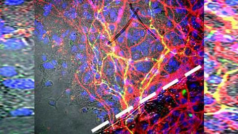Future brain therapies for Parkinson's possible with stem cell bioengineering innovation