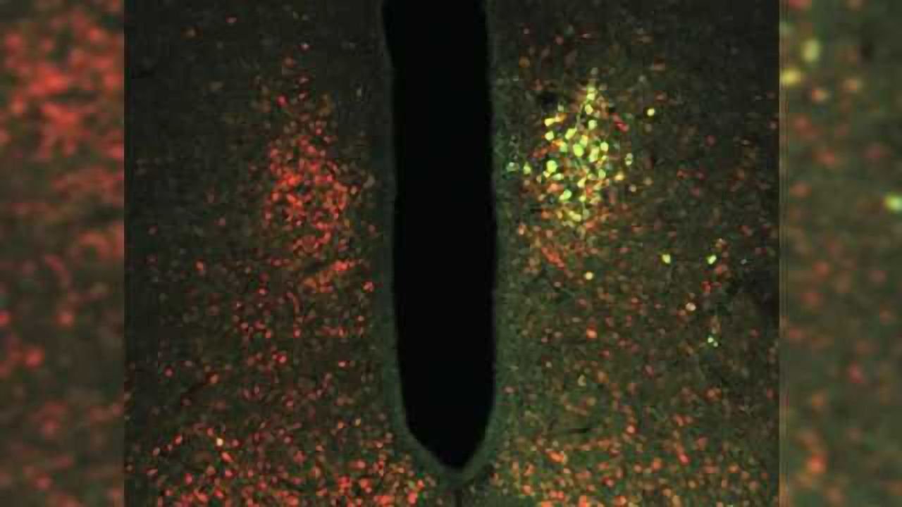 Using magnetic forces to control neurons, study finds brain is vital in glucose metabolism