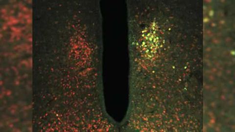 Using magnetic forces to control neurons, study finds brain is vital in glucose metabolism